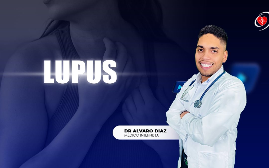 C046 - Lupus